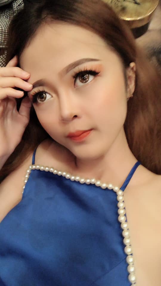 Nâng mũi bọc sụn