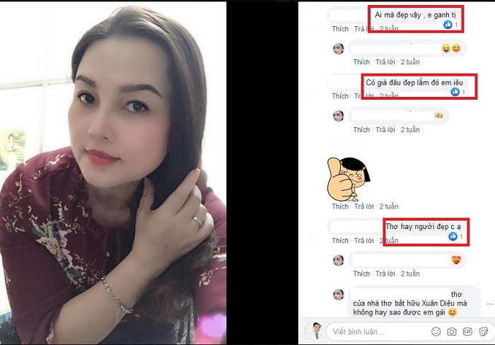Nâng mũi bọc sụn
