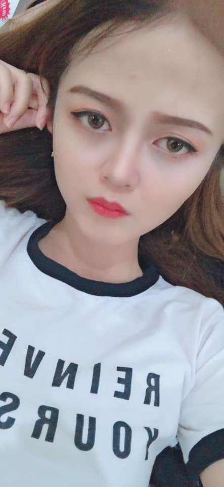 Nâng mũi bọc sụn