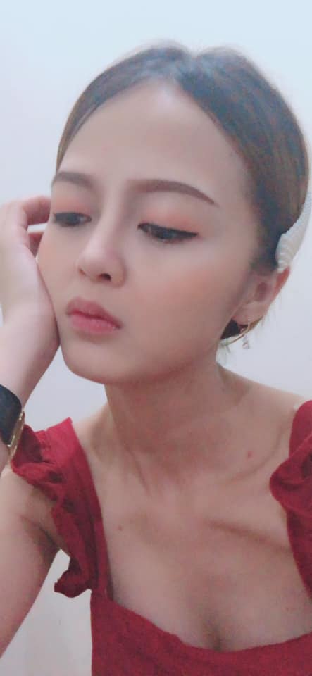 Nâng mũi bọc sụn