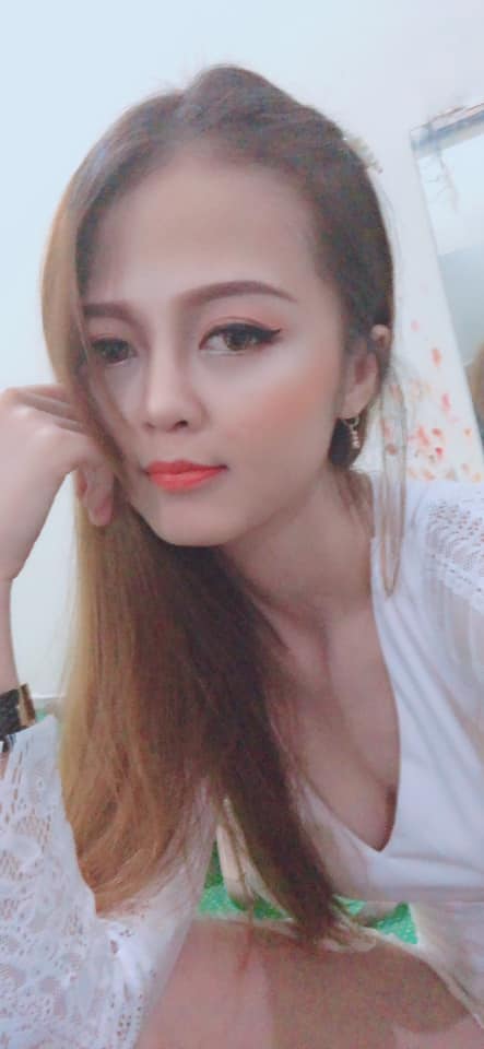 Nâng mũi bọc sụn