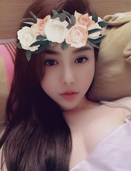 Cắt mí mắt