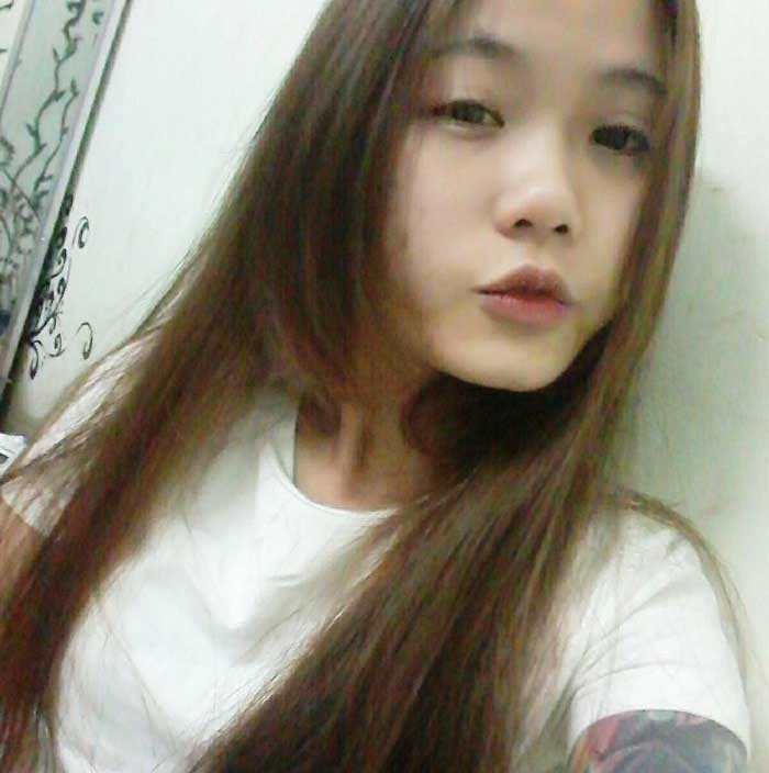 Nâng mũi bọc sụn