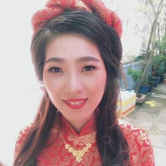 Nâng mũi bọc sụn