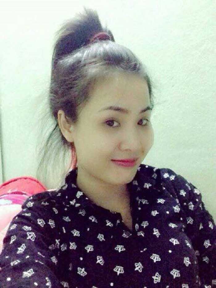 Nâng mũi Hàn Quốc