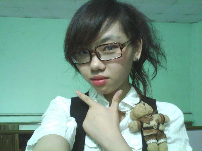 Nâng mũi bọc sụn