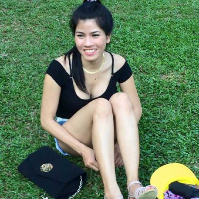 Lấy mỡ má