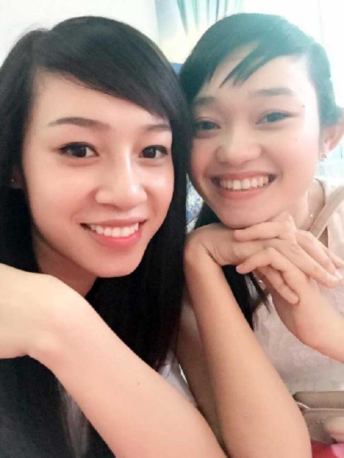 Nâng mũi bọc sụn