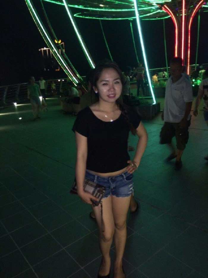 Lấy mỡ má