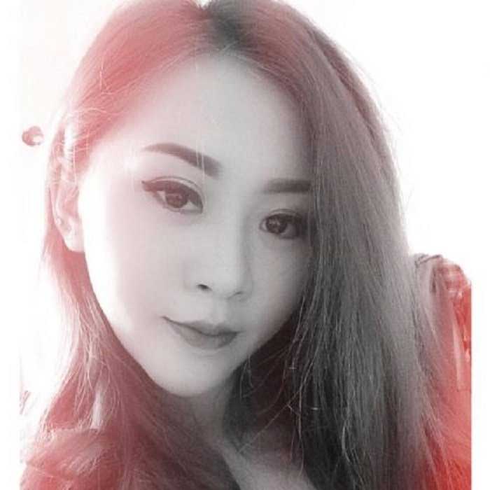 Nâng mũi bọc sụn