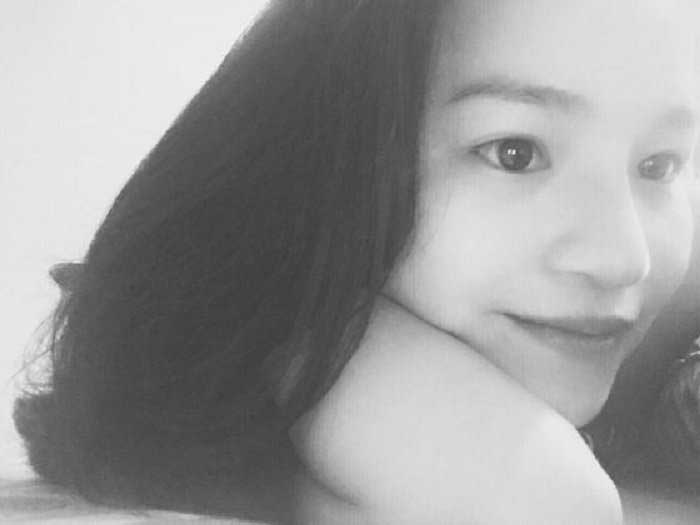 Nâng mũi bọc sụn