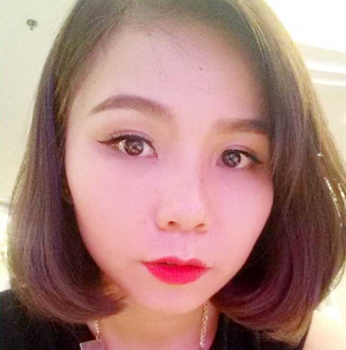 Cắt mí mắt