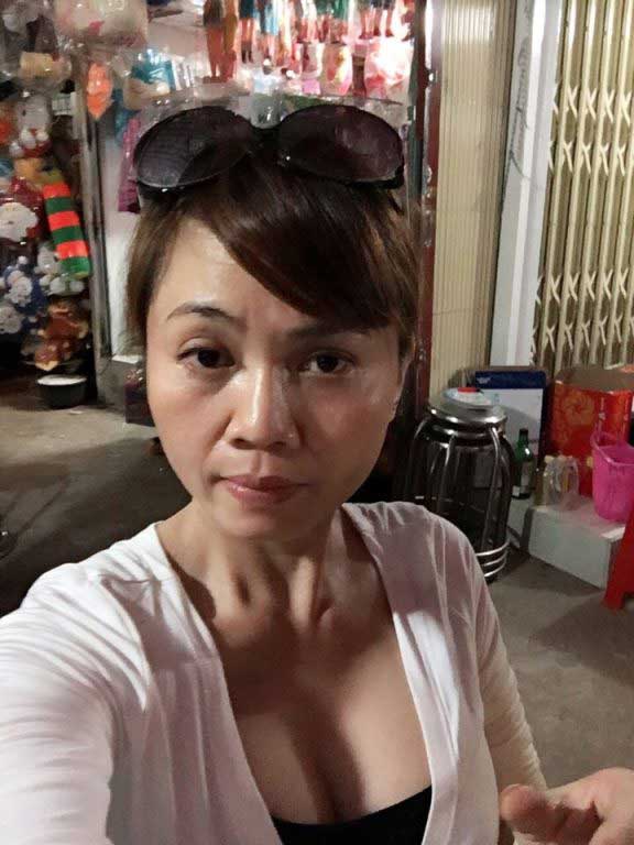 Nâng ngực nội soi