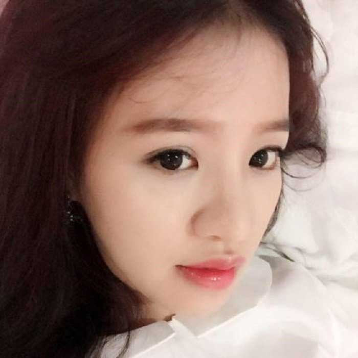 Nâng mũi bọc sụn
