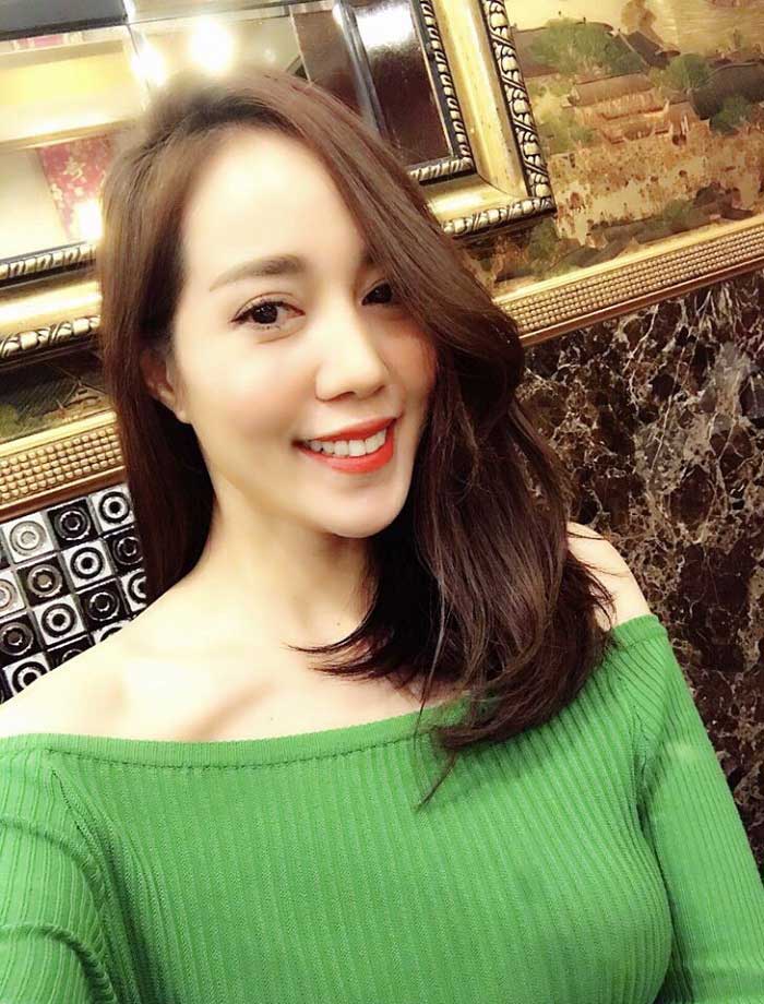 Cắt mí mắt