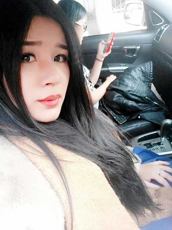 Nâng mũi S Line