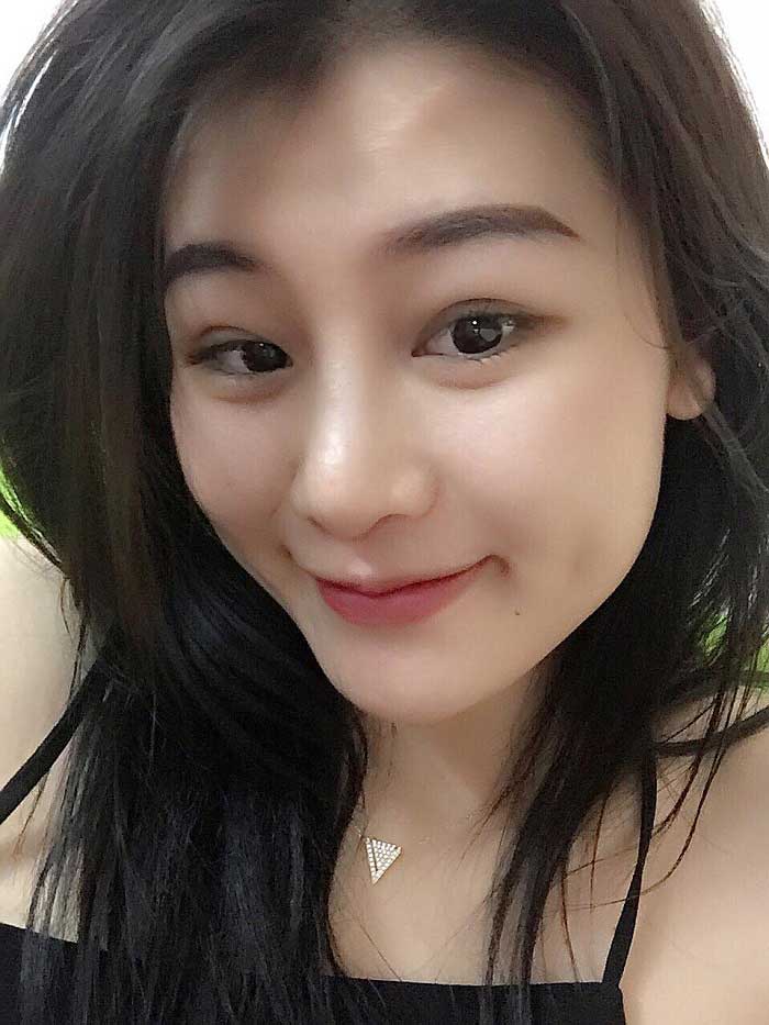 Cắt mí mắt