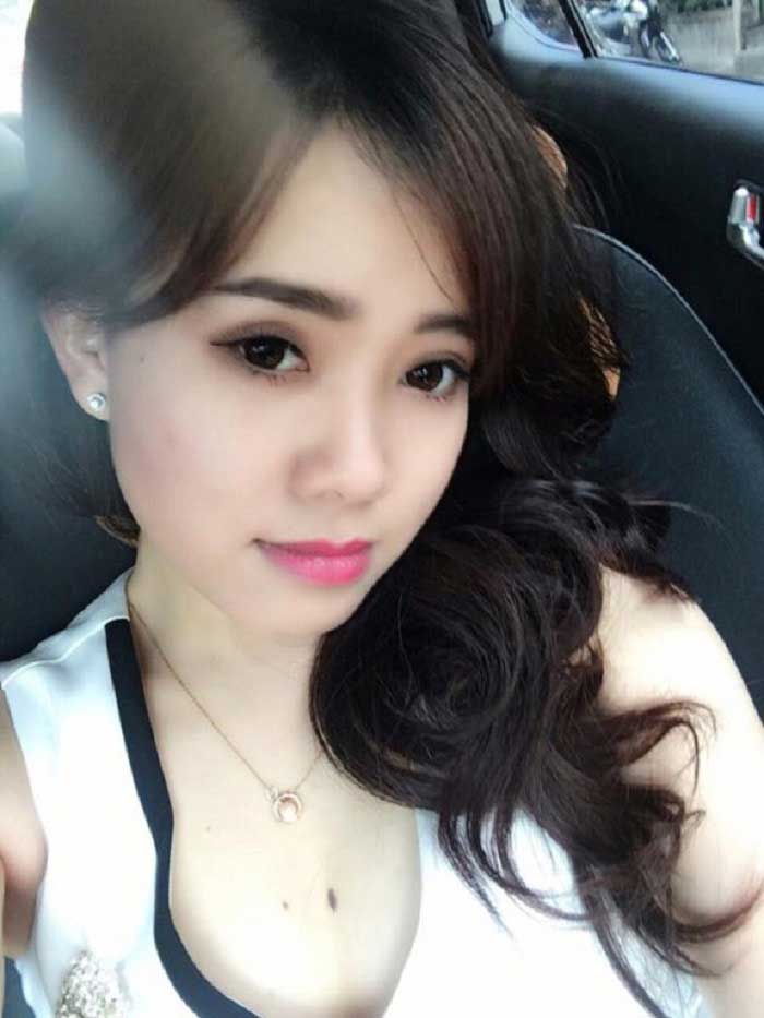 Nâng mũi bọc sụn