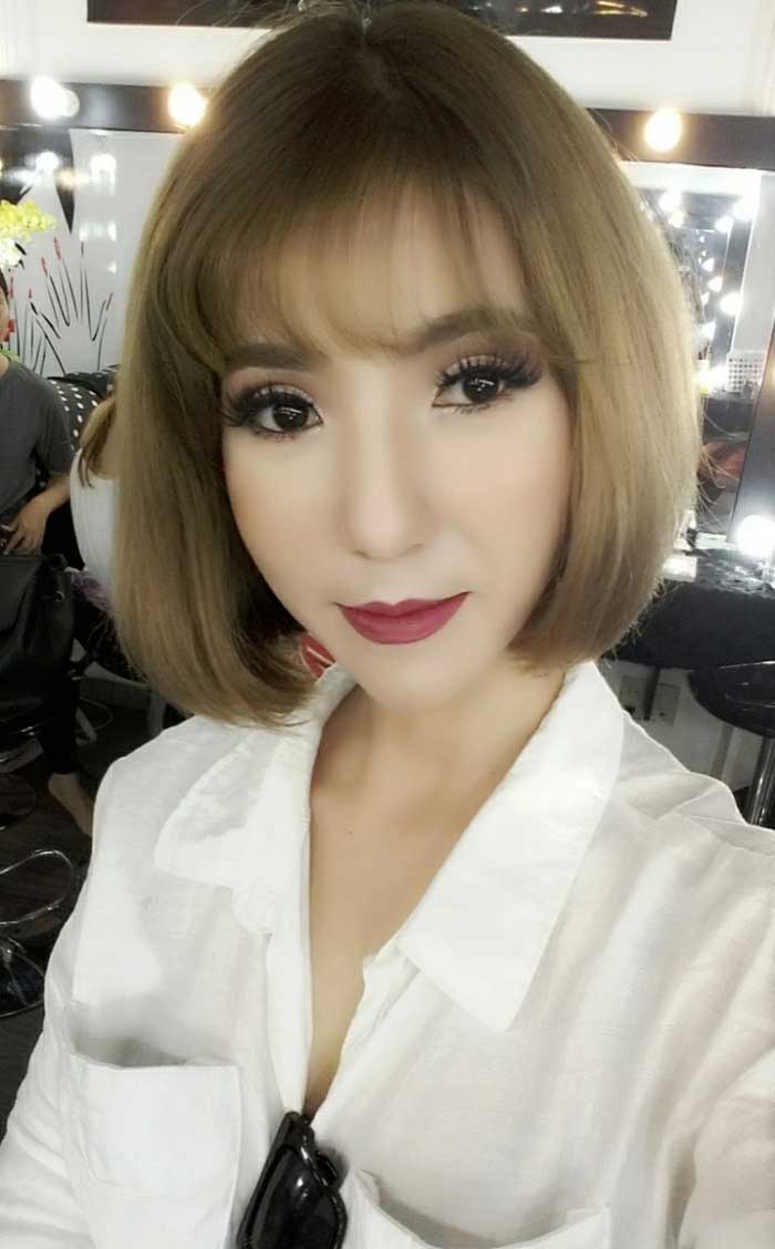 Cắt mí mắt