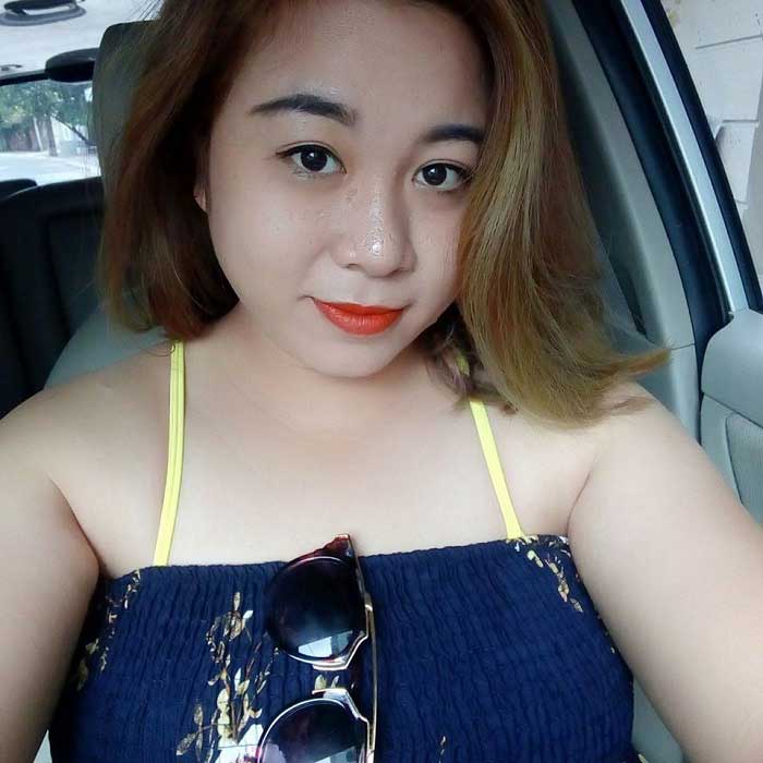 Cắt mí mắt