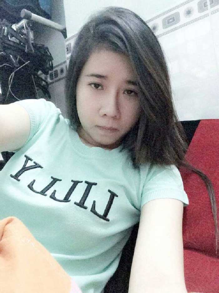 Nâng mũi bọc sụn