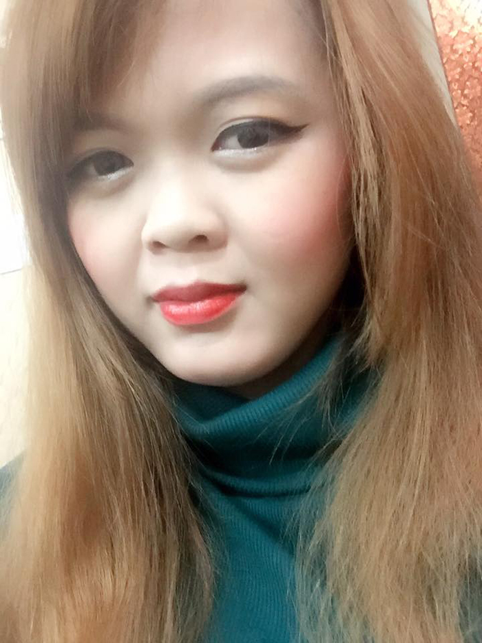 Nâng mũi bọc sụn