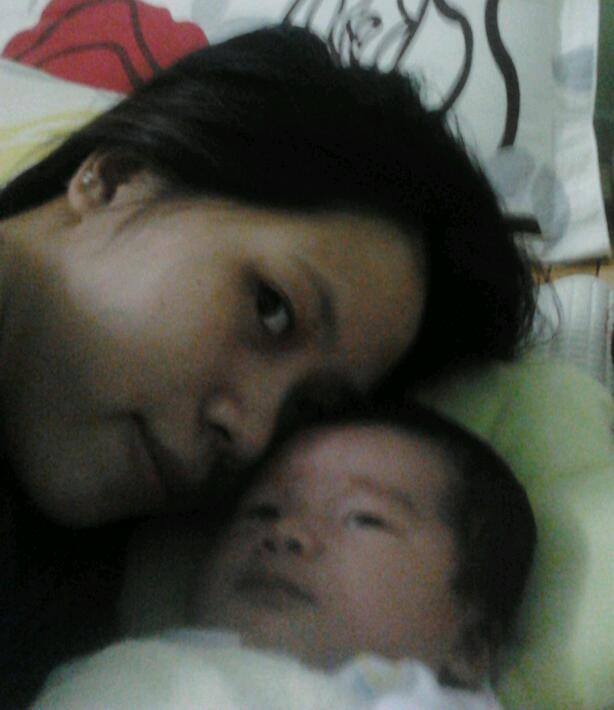 Nâng mũi bọc sụn