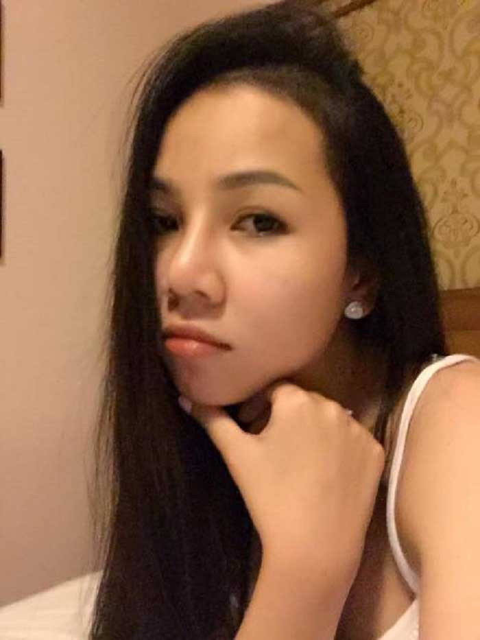 Nâng mũi Hàn Quốc