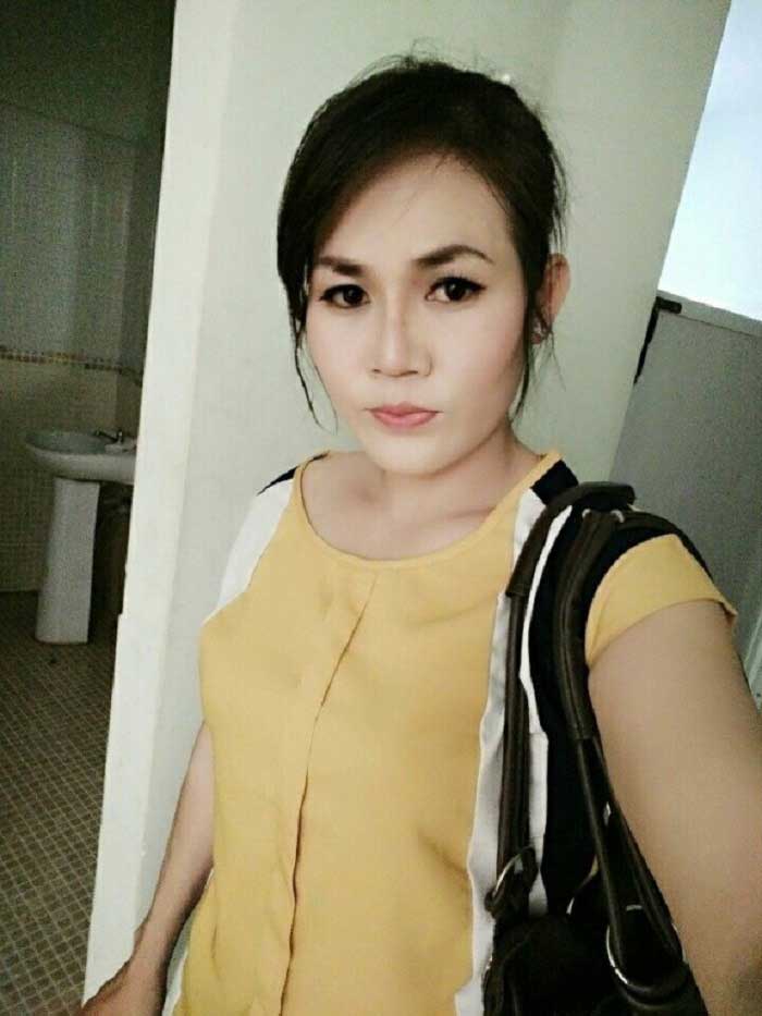 Nâng mũi bọc sụn