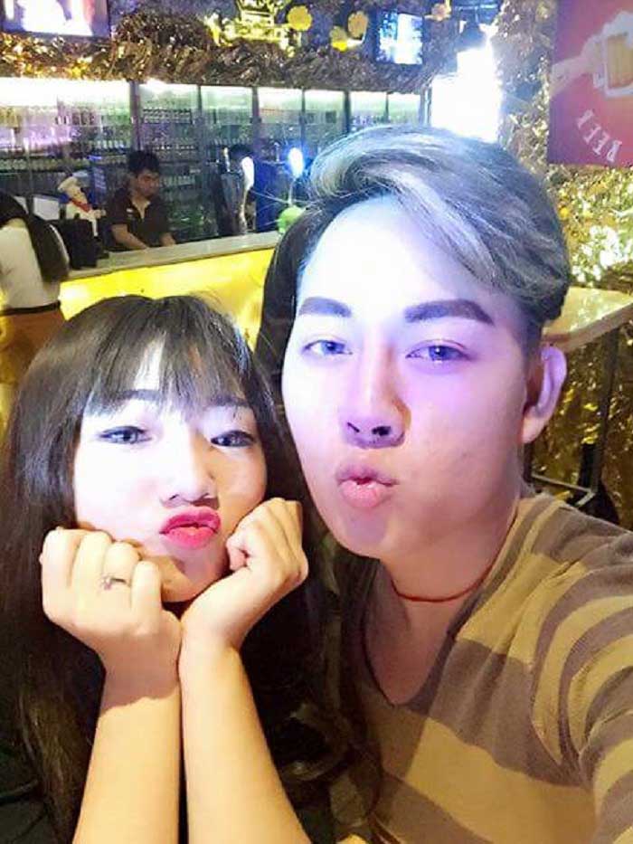 Nâng mũi bọc sụn