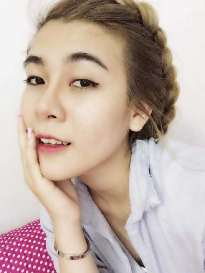 Nâng mũi Hàn Quốc