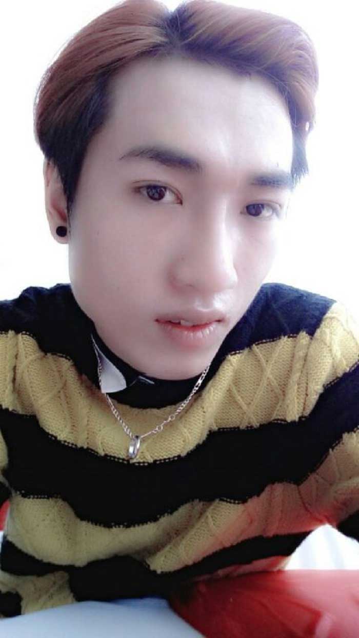 Cắt mí mắt