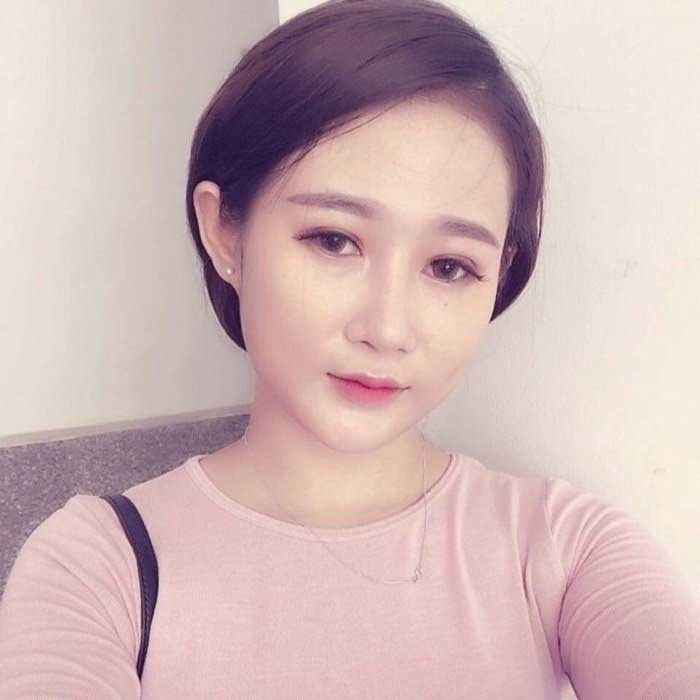 Nâng mũi Hàn Quốc