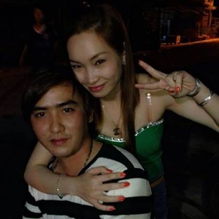 Nâng mũi bọc sụn