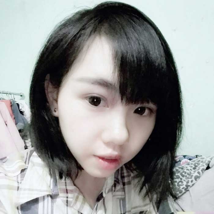 Độn cằm