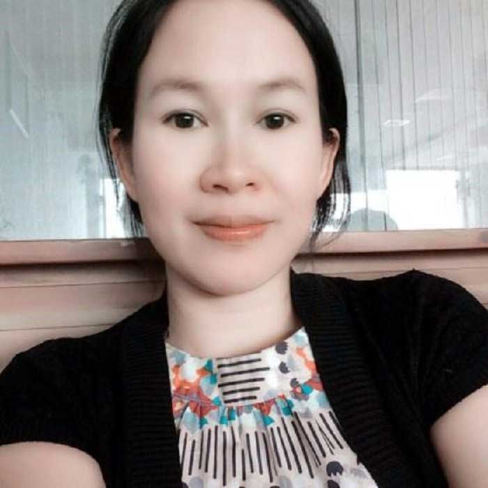 Cắt mí mắt