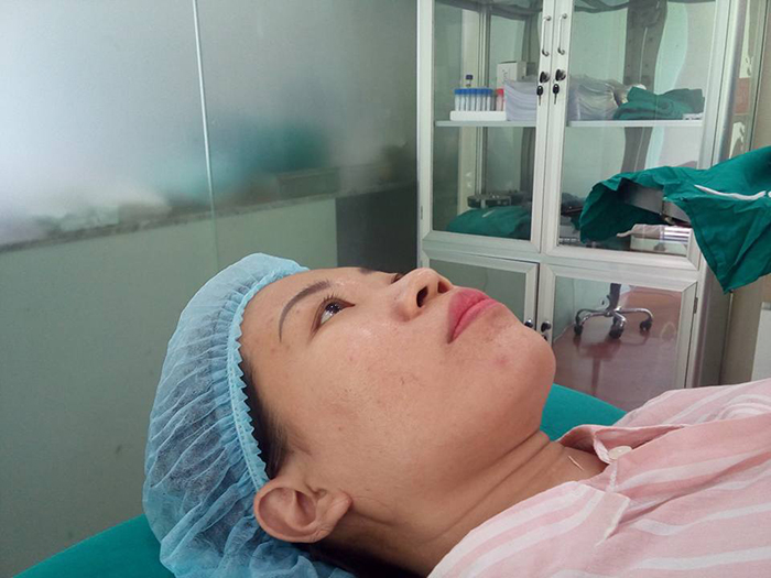 Nâng mũi Hàn Quốc