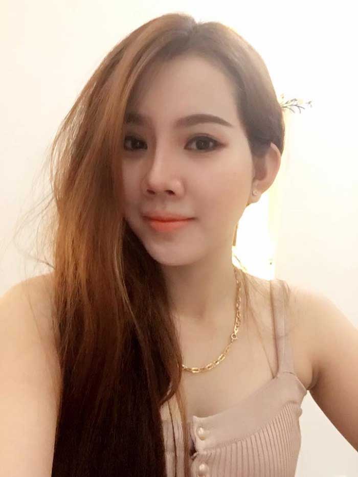 Nâng mũi bọc sụn