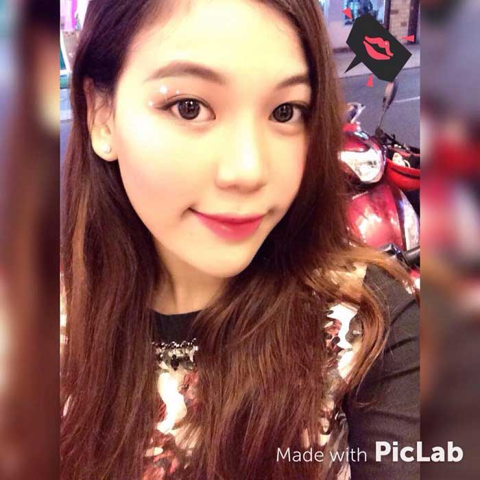 Bấm mí Hàn Quốc