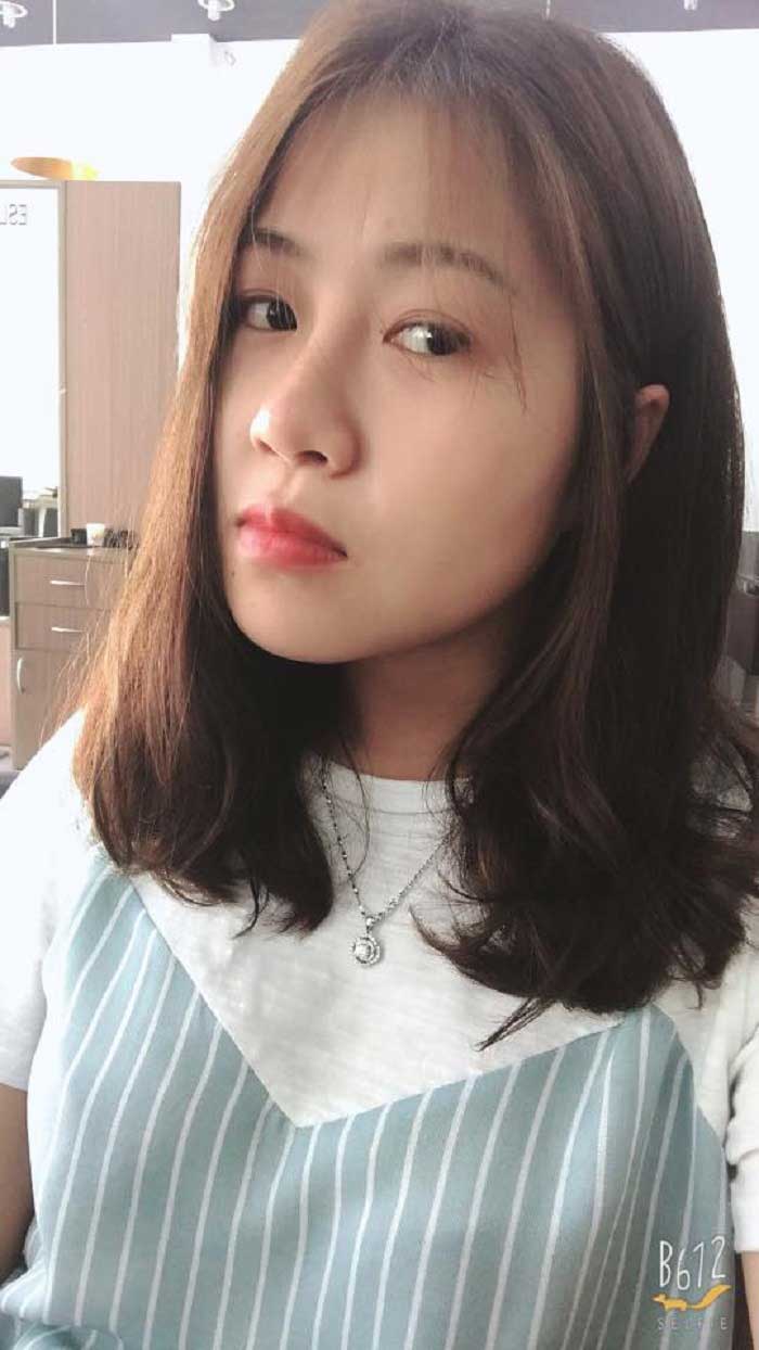 Nâng mũi bọc sụn