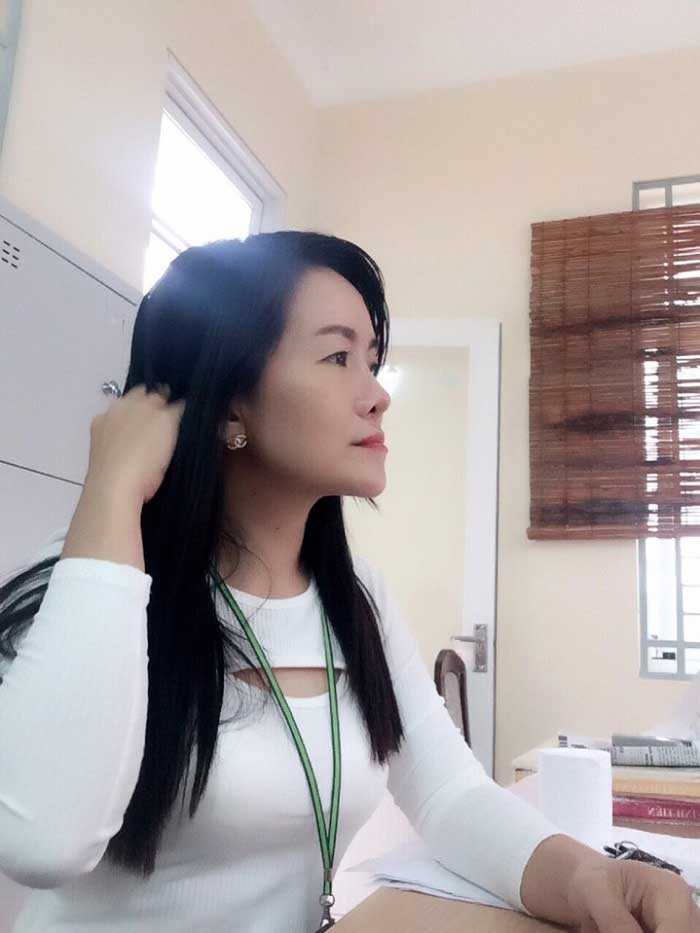 Nâng mũi bọc sụn Nâng mũi bọc sụn