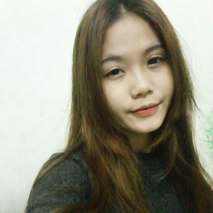 Nâng mũi bọc sụn