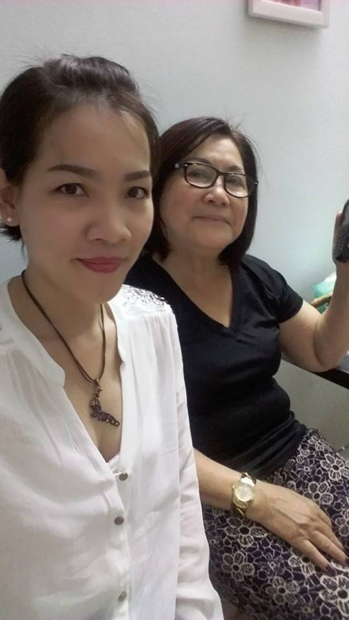 Cắt mí mắt