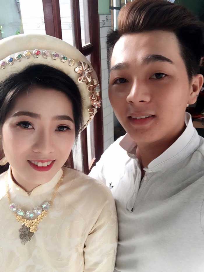 Nâng mũi bọc sụn