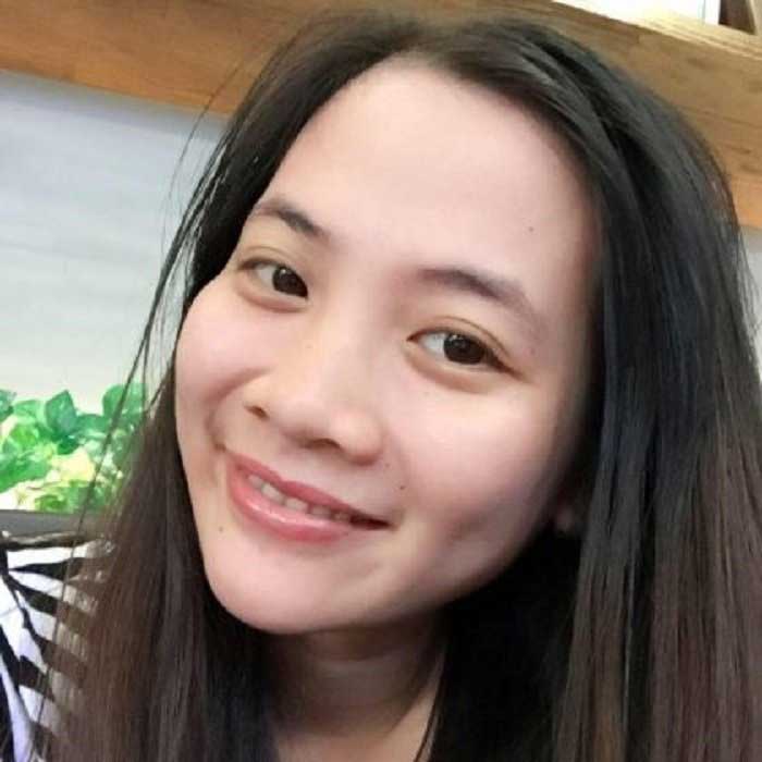 Nâng mũi bọc sụn