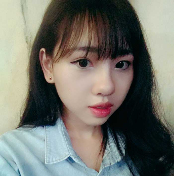 Nâng mũi bọc sụn
