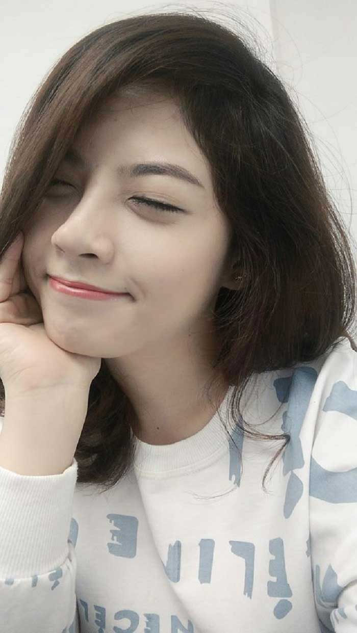 Nâng mũi bọc sụn
