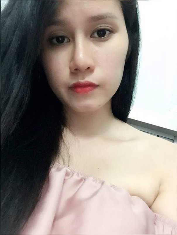 Nâng mũi S Line