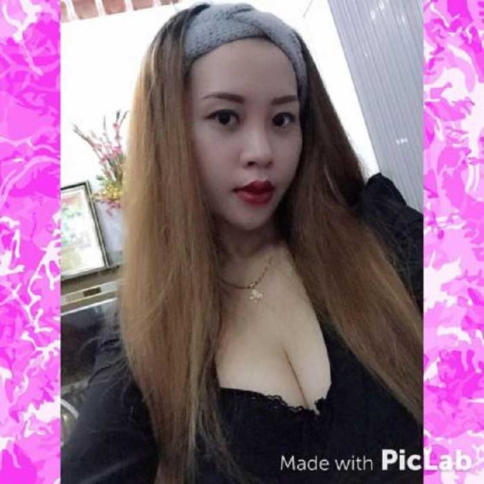 Nâng mũi bọc sụn