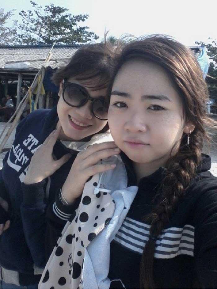 Lấy mỡ má